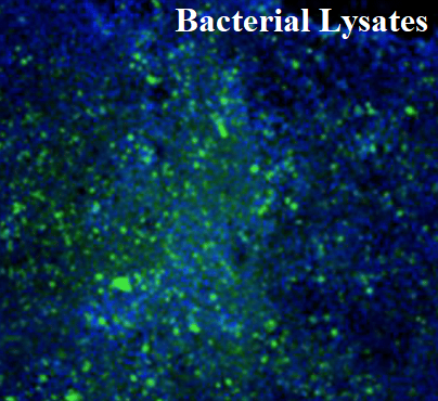Hình ảnh của Lyophilized Bacterial Lysates (OM-85)