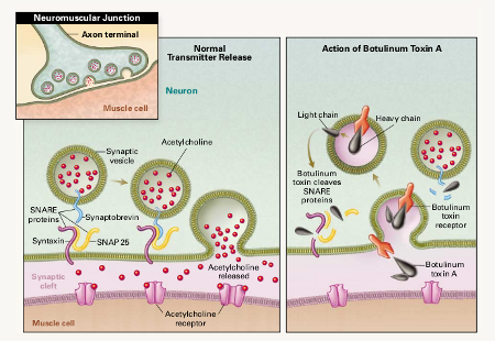 Káº¿t quáº£ hÃ¬nh áº£nh cho botulinum toxin type mechanism