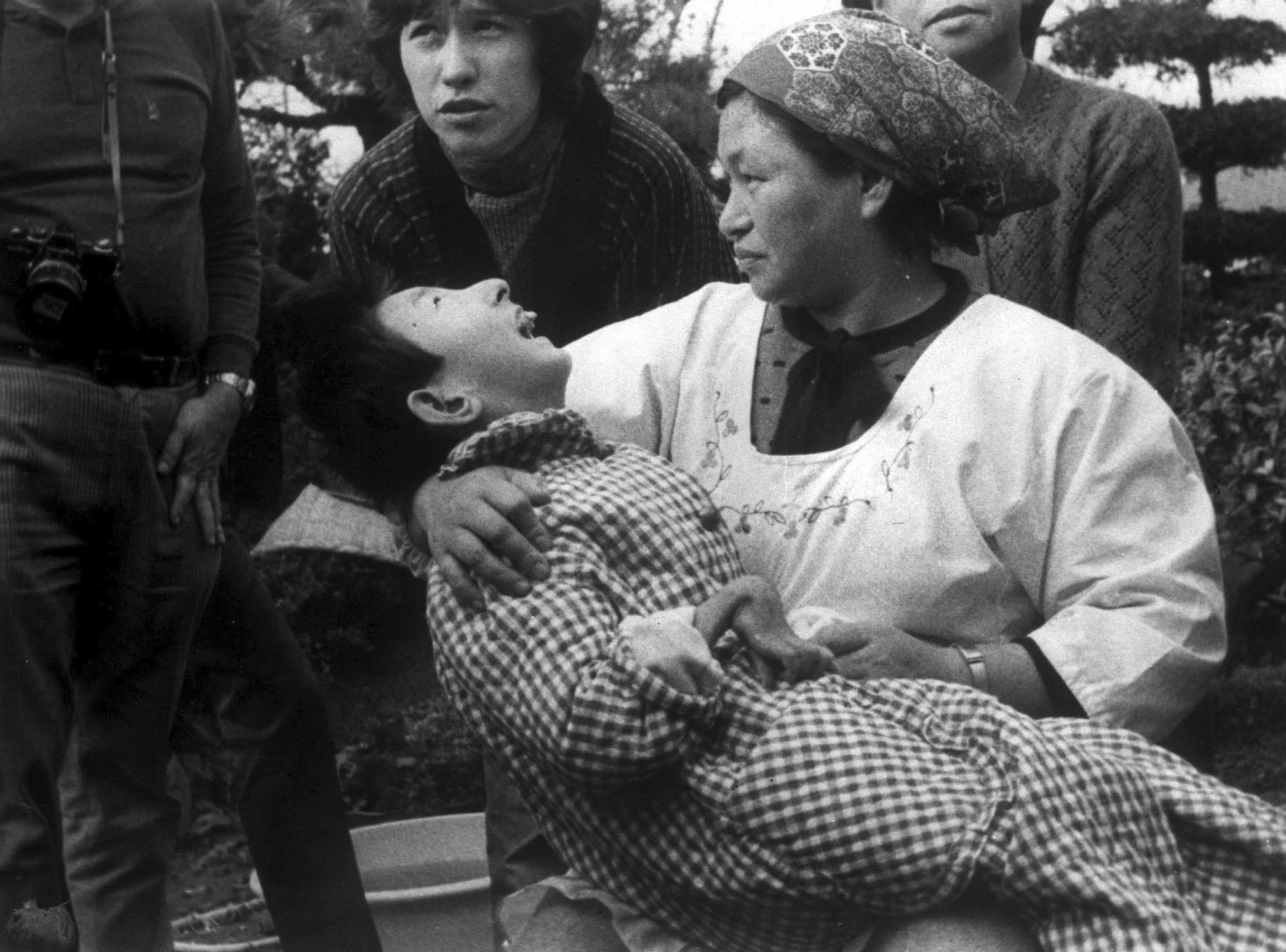 Kết quả hình ảnh cho mercury poisoning